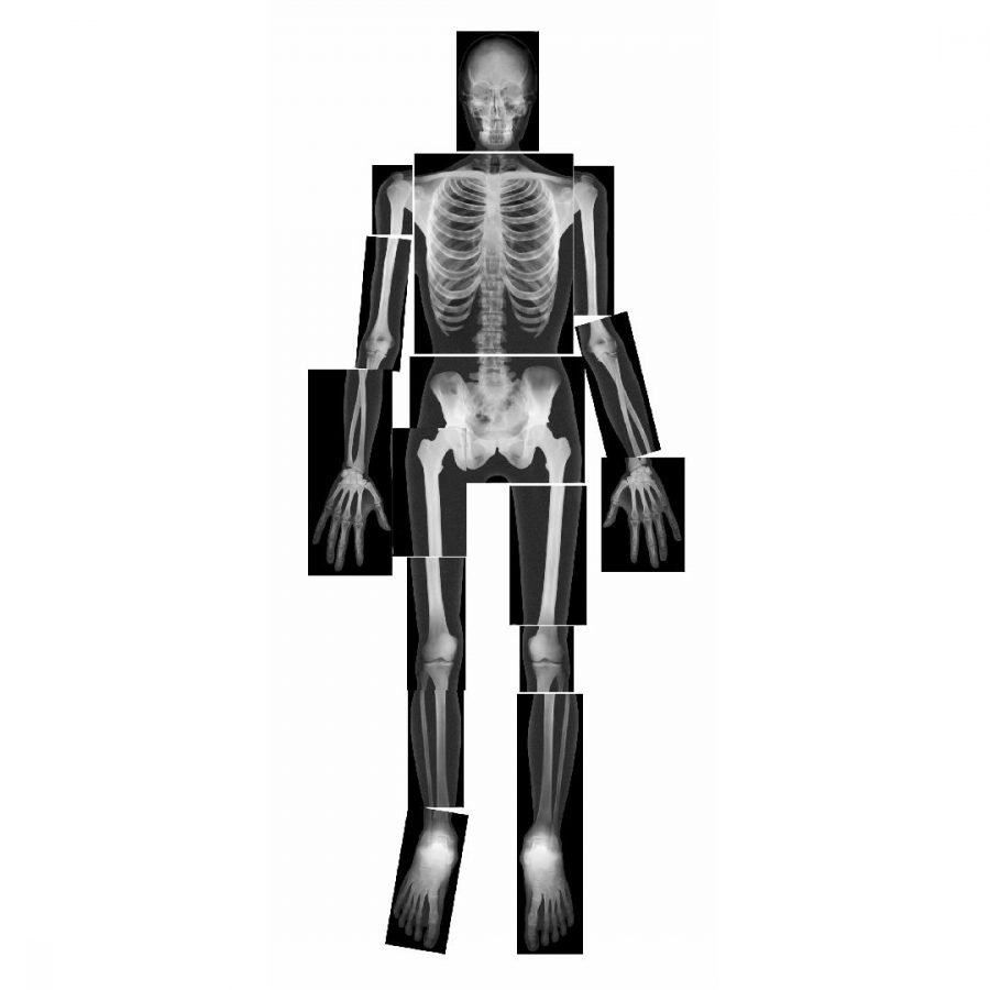 True to Life Human X-rays (18pcs)